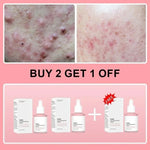 Serum Facial de Péptidos de Colágeno y PDRN