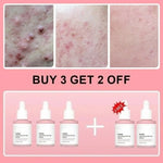 Serum Facial de Péptidos de Colágeno y PDRN